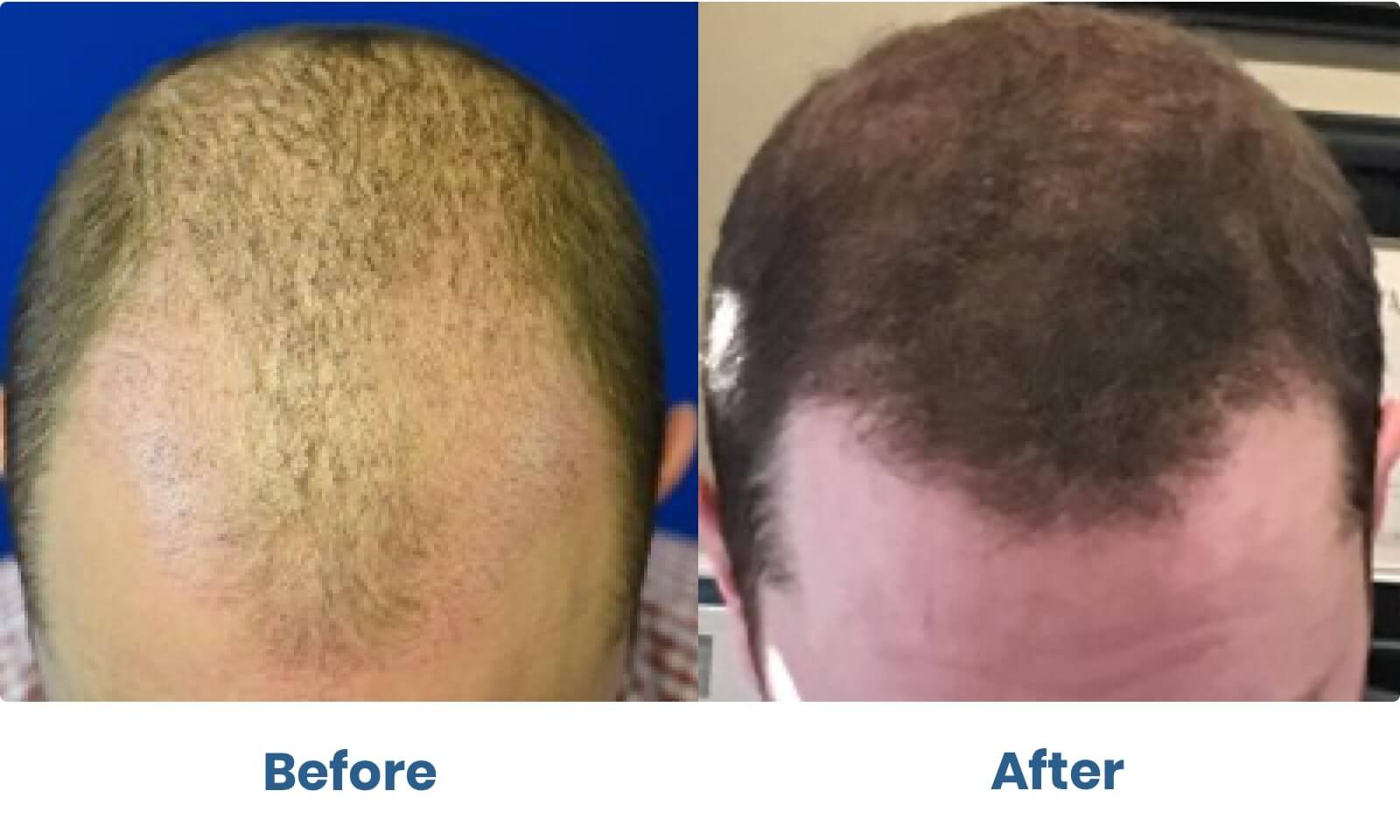 Before and after photo of hair treatments