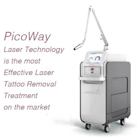 Pico laser with text that reads, PicoWay laser technology is the most effective tattoo removal treatment on the market